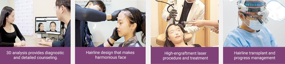 3D analysis provides diagnostic and detailed counseling. / Hairline design that makes harmonious face / High-engraftment laser procedure and treatment / Hairline transplant and progress management