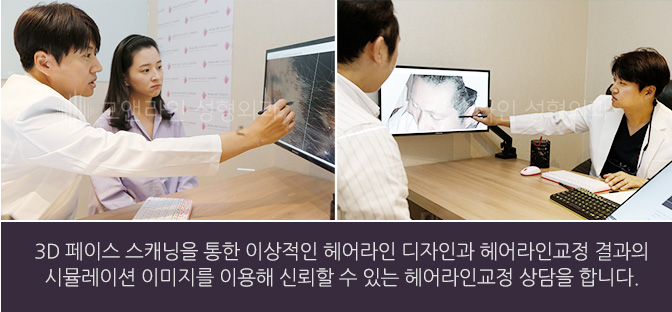 3D 페이스 스캐닝을 통한 이상적인 헤어라인 디자인과 헤어라인교정 결과의 시뮬레이션 이미지를 이용해 신뢰할 수 있는 헤어라인교정 상담을 합니다.