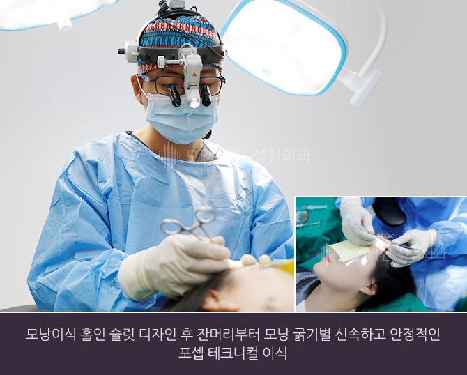 모낭이식 홀인 슬릿 디자인 후 잔머리부터 모낭 굵기별 신속하고 안정적인 포셉 테크니컬 이식