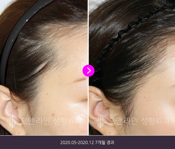 2020.05-2020.12 7개월 경과