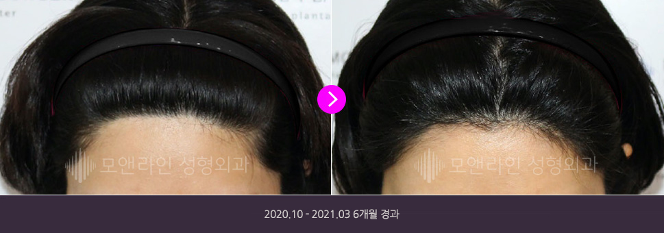 2020.10 - 2021.03 6개월 경과