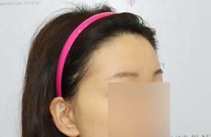 치료후기 이미지