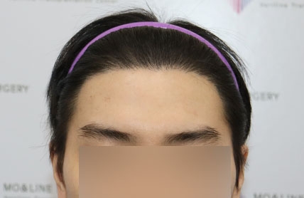 치료후기 이미지
