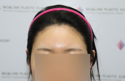 치료후기 이미지